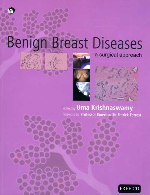 Orient Benign Breast Diseases: A Surgical Approach